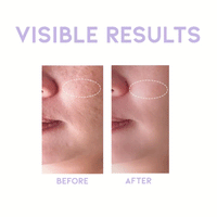 OOTD Glycolic Exfoliating Toner P.M 250ml - DODOSKIN