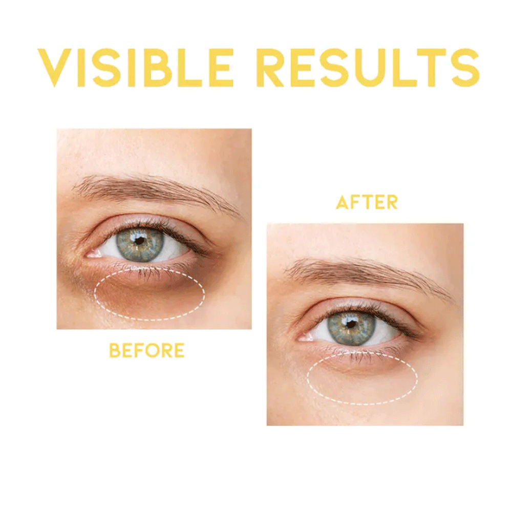 Buy Korean OOTD Dark Circle Eye Serum 30g Online DODOSKIN