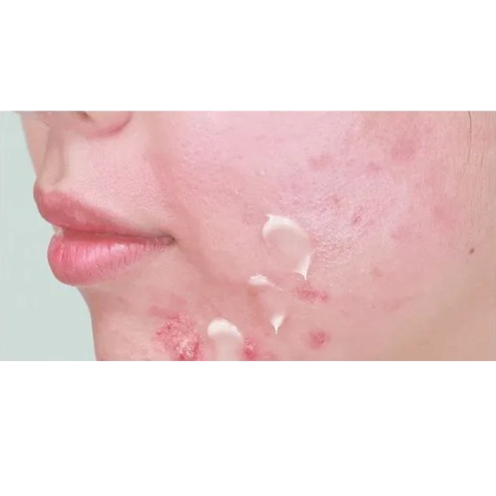 Dr.want Retinol Dream 17g - DODOSKIN