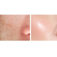 The cream features a blend of Cica and snail mucin to soothe, repair, and hydrate the skin. 