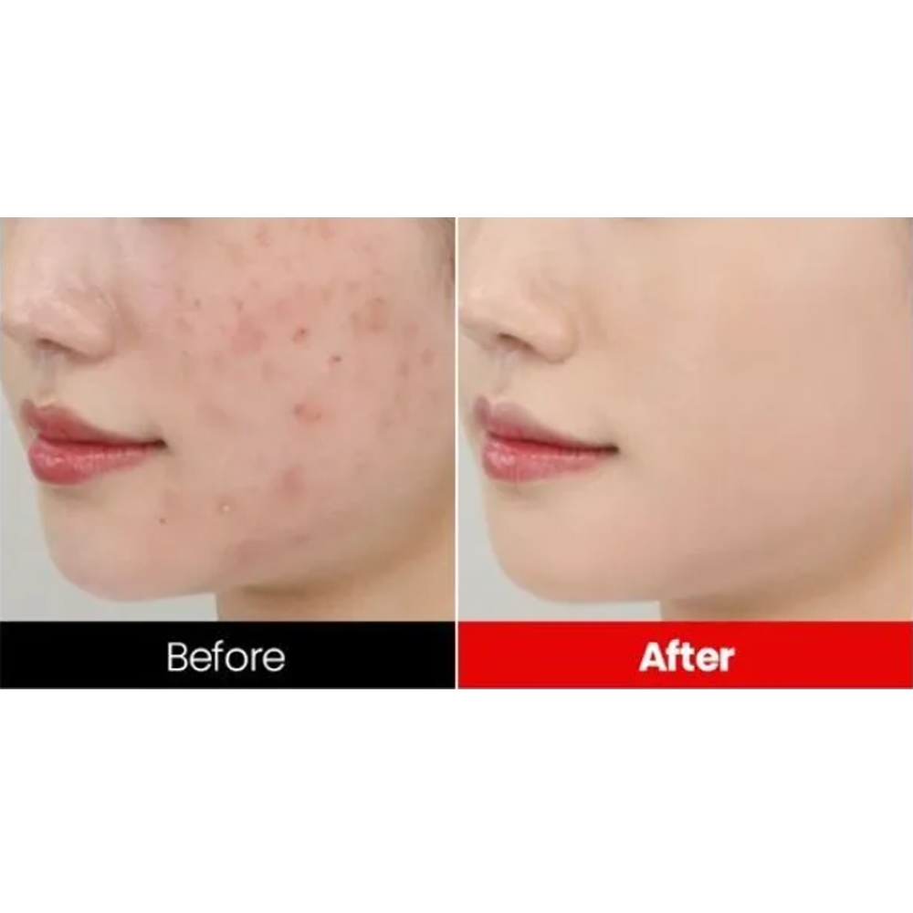 Dr.want Red Concealer 32ml - DODOSKIN