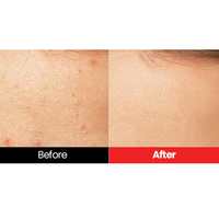 Dr.want Red Pore Pad 70 pads - DODOSKIN