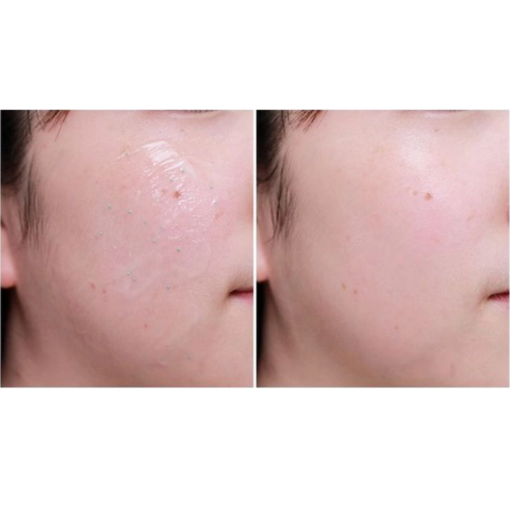 TOSOWOONG SOS Tightening Pore Clinic Pore Tight Sleeping Pack 50g - DODOSKIN