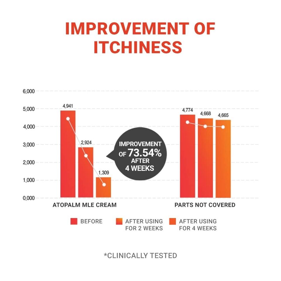 ATOPALM MLE Cream 160ml [Renewal] - DODOSKIN