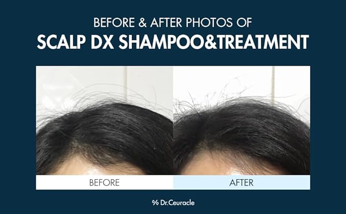 Dr.Ceuracle Scalp DX Scaling Shampoo 500ml - DODOSKIN