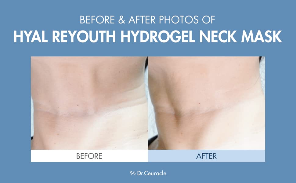 Dr.Ceuracle Hyal Reyouth Hydrogel Neck Mask 11g*10ea - DODOSKIN