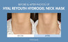 Dr.Ceuracle Hyal Reyouth Hydrogel Neck Mask 11g*10ea - DODOSKIN