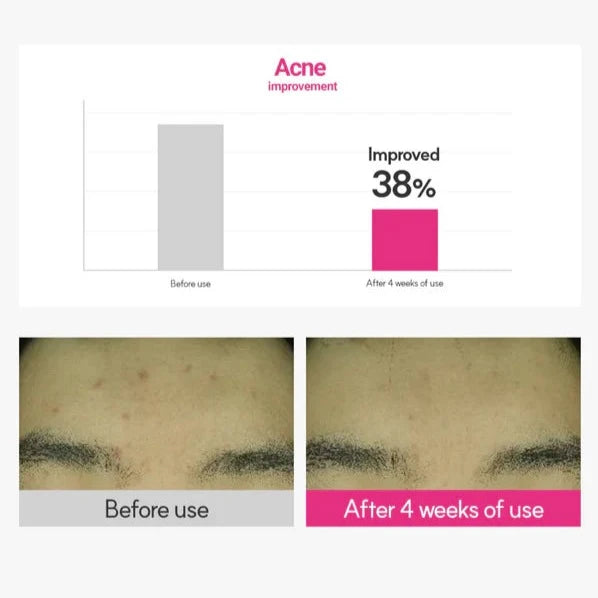 (Matthew) ROVECTIN Cica Care Blemish Clearing Cream 50ml - DODOSKIN