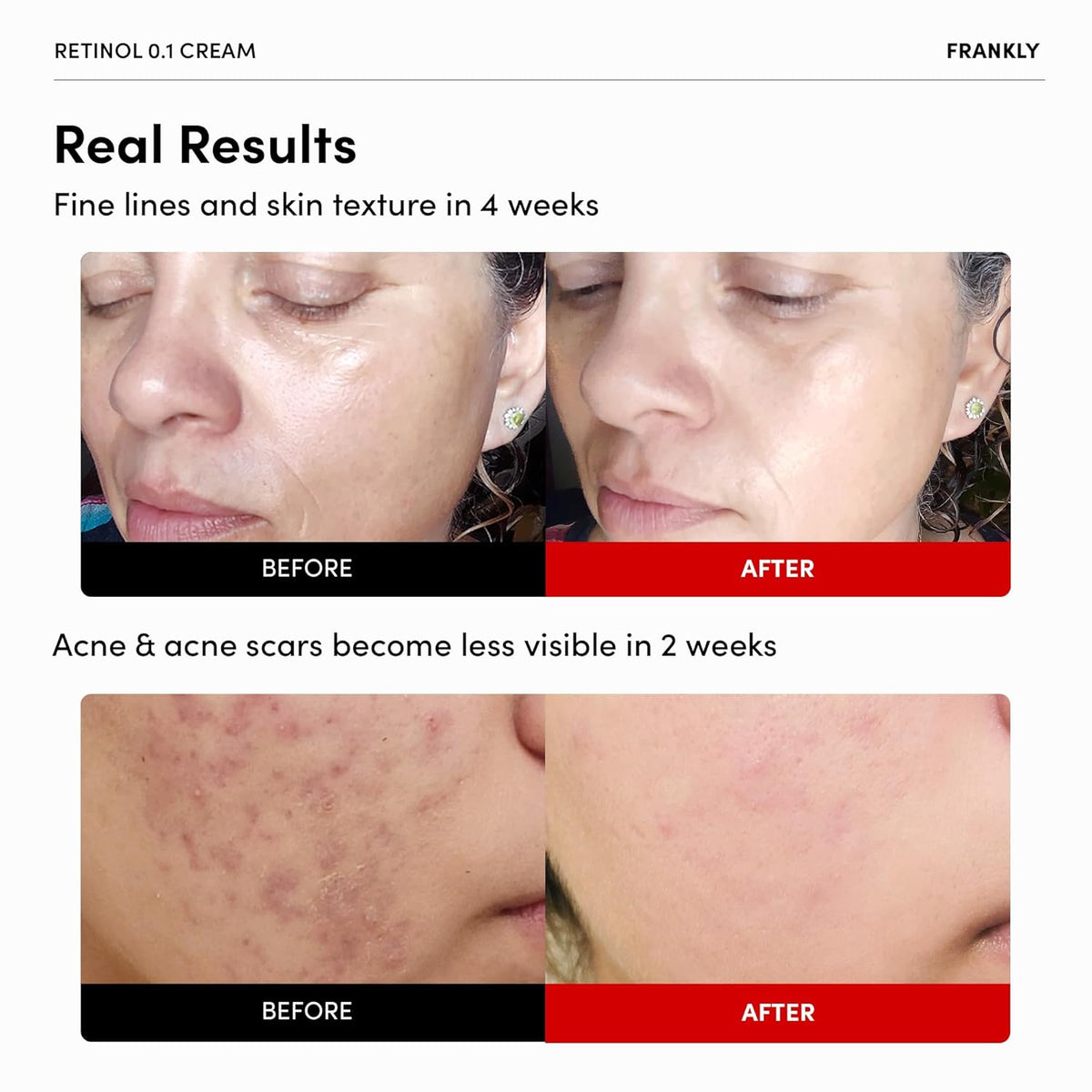 FRANKLY Retinol 0.3% Cream 20ml