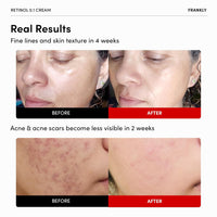 FRANKLY Retinol 0.3% Cream 20ml