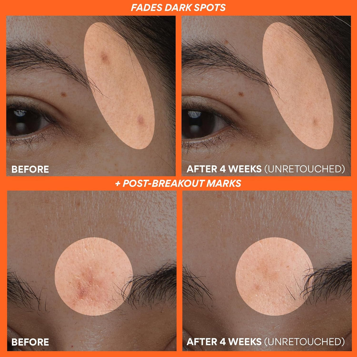 Innisfree Vitamin C Green Tea Enzyme Brightening Serum 50ml