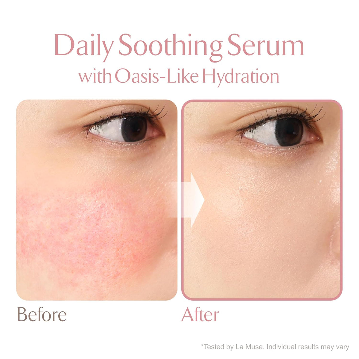 LAMUSE Oasis Soothing Serum 200ml