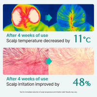 lilyeve Scalp:Turn Cica PDRN Brush Ampoule 100ml