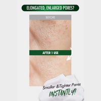 NEOGEN Pore Zero Peeling Mousse 100ml