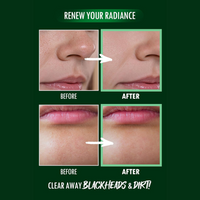 NEOGEN Pore Zero Peeling Mousse 100ml