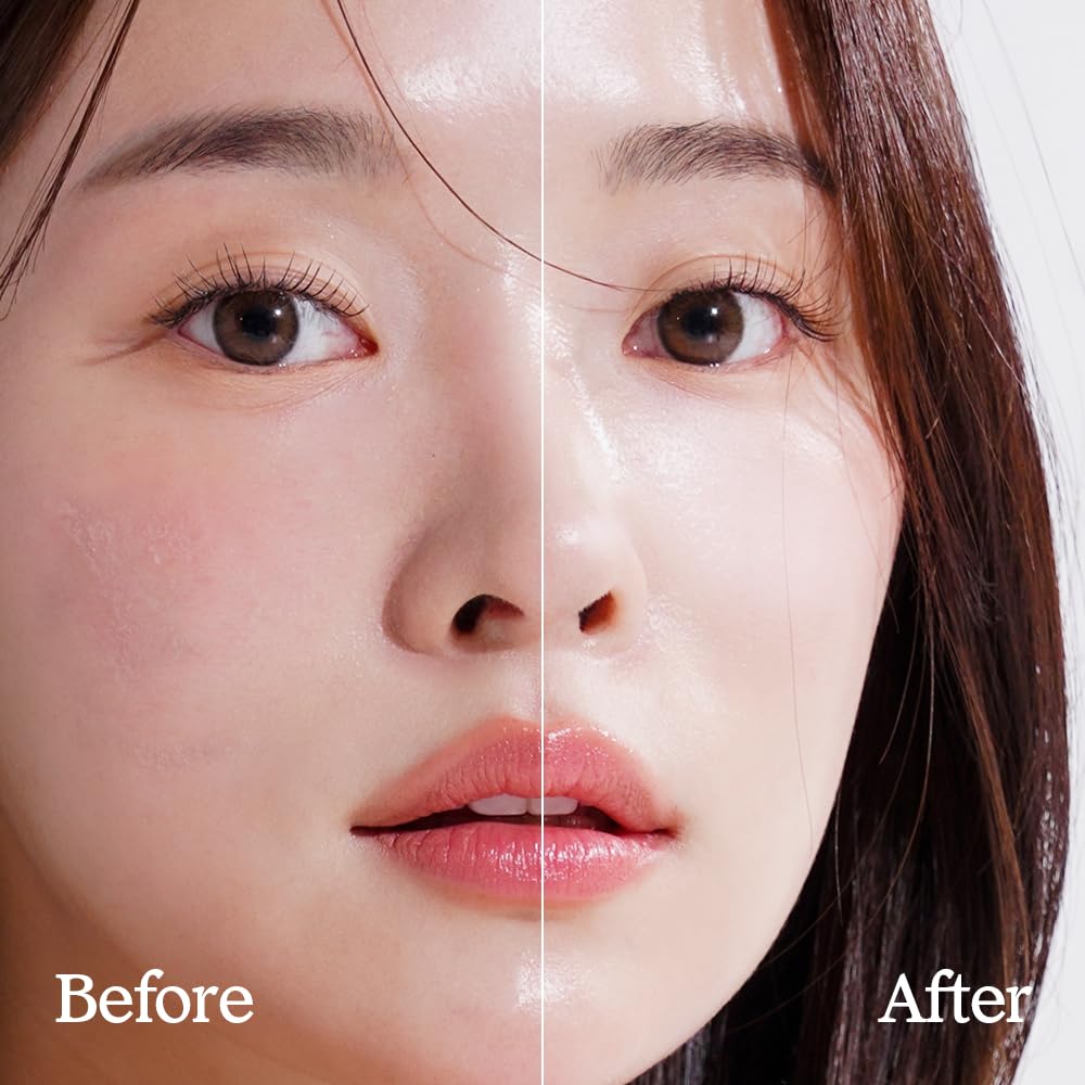 Natural Derma Project Ha Boosting Serum 30ml