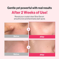 Re:dence Tone & Spot Corrector Ampoule 30ml