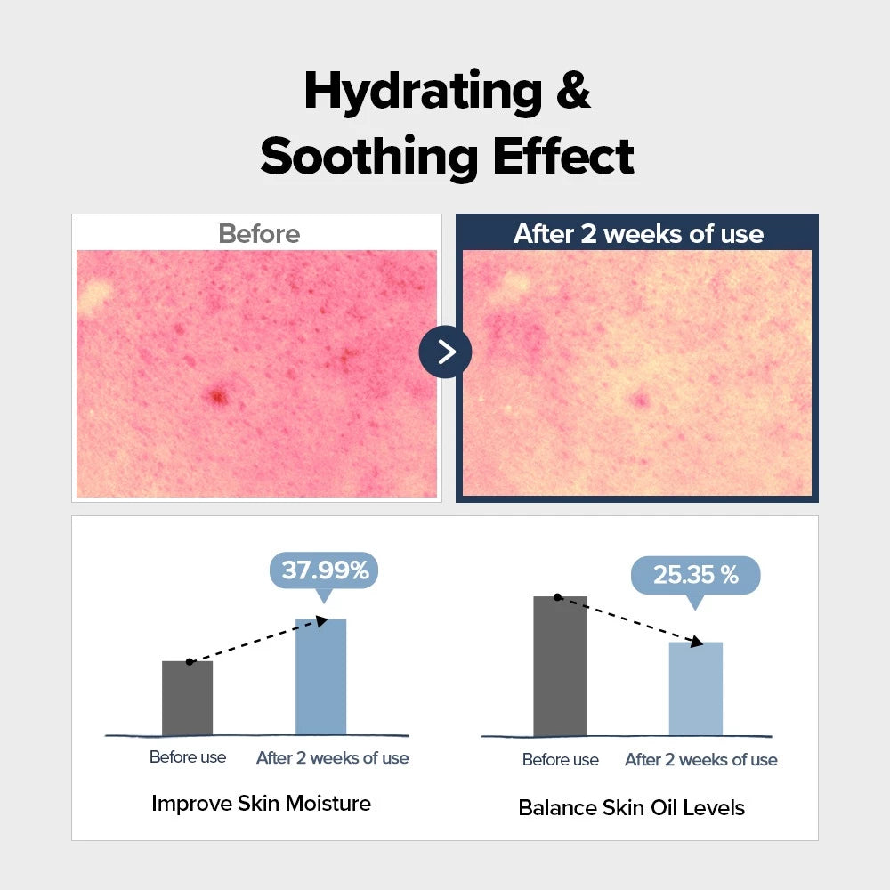 SKINFOOD Manzanilla azul ampolla hialurónica 50 ml