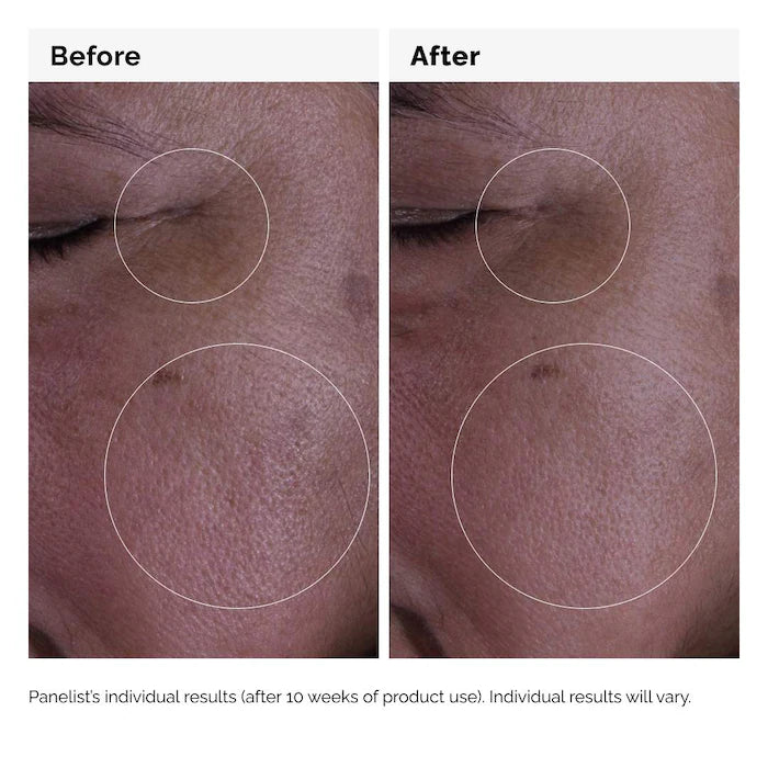 The Ordinary GF 15% Solución 30 ml