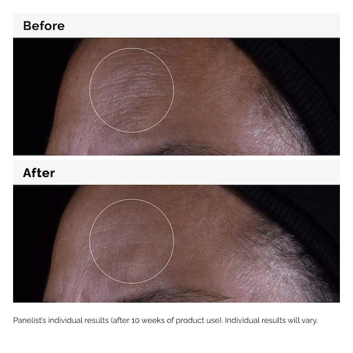 The Ordinary GF 15% Solución 30 ml