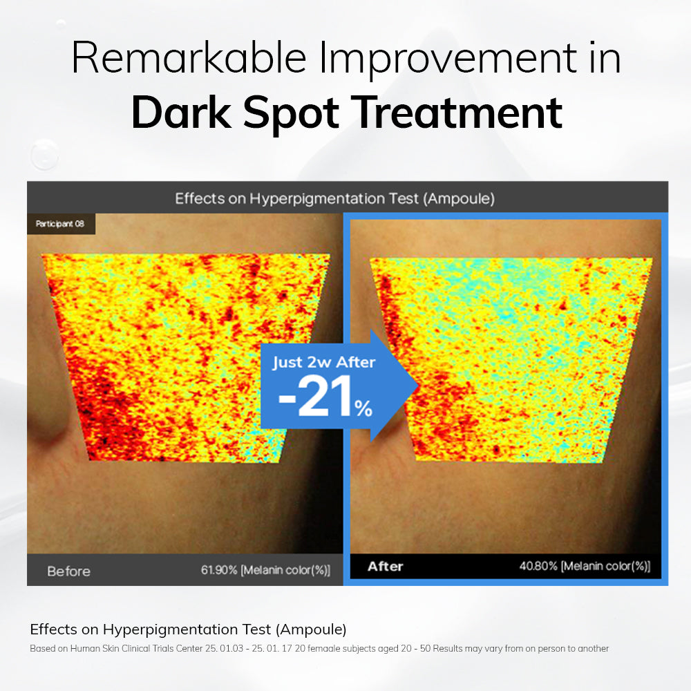 MIMU MIMU Niacindy Dark Spot Ampoule 15ml