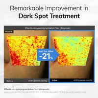 MIMU MIMU Niacindy Dark Spot Ampoule 15ml