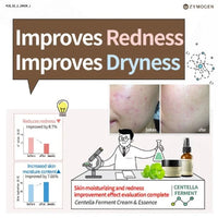 ZYMOGEN Centella Ferment Cream 50ml - DODOSKIN