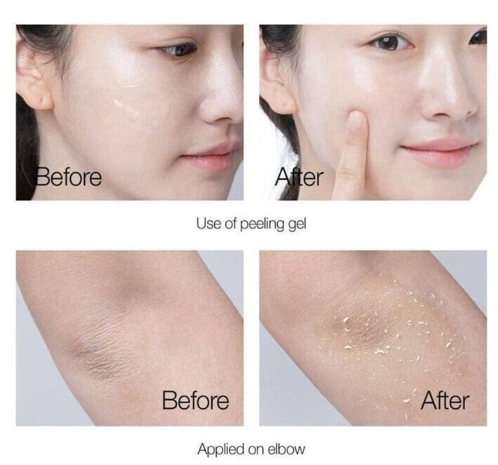 Pretty skin The Pure Jeju Cica Peeling Gel 150ml - DODOSKIN