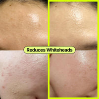 simplemente funciona sesu Good Moring Cleanser 100G