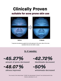 COSRX The Niacinamide 15 Serum 20ml - DODOSKIN